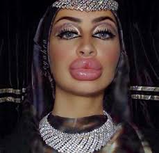 she has the biggest lips in the world