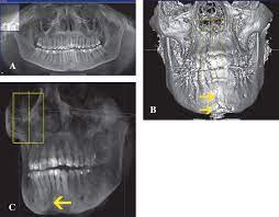 cone beam computed tomography