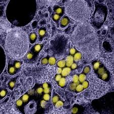 Fotos reales del coronavirus bajo el microscopio | Fotogalería | Ciencia y  tecnología | Cadena SER