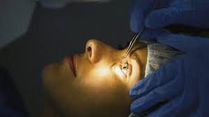 Food & drug administration approved lasik corrective eye surgery, millions of americans have successfully undergone the procedure and ditched their glasses. Laser Eye Surgery Benefits Risks And What To Expect