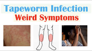weird symptoms of tapeworm infection
