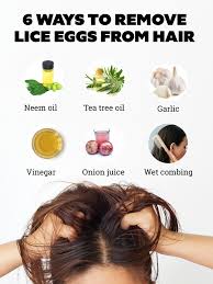 how to remove lice eggs from hair using
