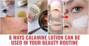 using calamine lotion