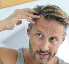 5 causes of dandruff and how to treat