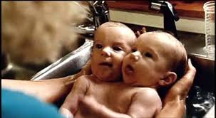 Abigail loraine hensel and brittany lee hensel (born march 7, 1990) are american conjoined twins. Videogram Abigail Brittany Hensel The Twins Who Share A Body