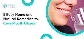 home cure for mouth ulcers home