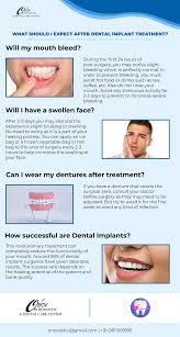 dental implants in south delhi orion