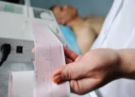 How To Read An Electrocardiogram Ekg Ecg Nurse Org