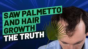 What does exist, are products that can help stop further hair loss. Saw Palmetto And Hair Growth The Truth Youtube
