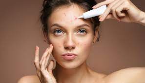 acne scars best acne remes