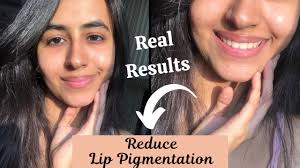 how to get rid of lip pigmentation