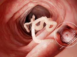 what are tapeworms and how do they grow