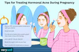 hormonal acne during pregnancy