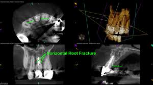 the importance of cone beam ct for