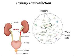 urinary tract infection greenview