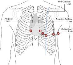 But this number may be increased by the development of a cervical or lumbar rib, or may be diminished to eleven. Chest Leads Ecg Lead Placement Normal Function Of The Heart Cardiology Teaching Package Practice Learning Division Of Nursing The University Of Nottingham