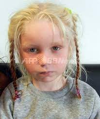 保護された「金髪の少女」、先天性色素欠乏症の可能性 写真2枚 国際ニュース：AFPBB News
