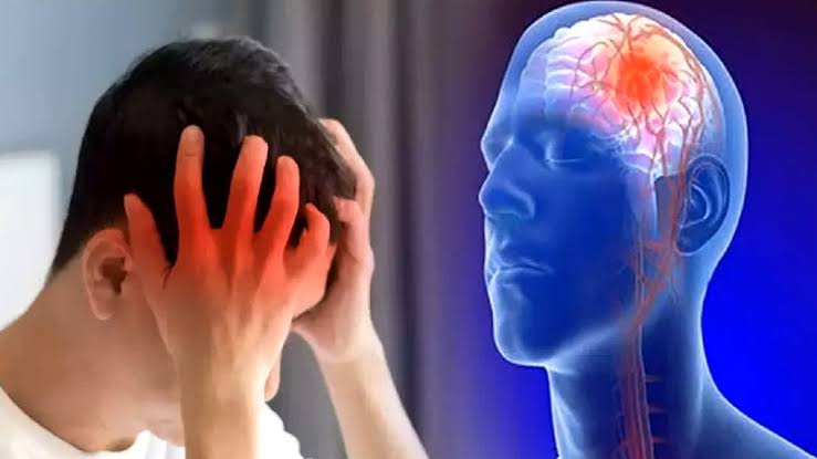 Ictus cerebral: síntomas, causas y ayuda | Hospital Desun