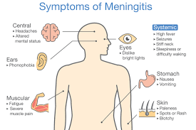 A skin rash may or may not be present with the other symptoms of meningitis. Doctors Warn New Students To Be Wary Of Meningitis Risk Inside Croydon