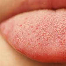 5 things your tongue may be trying to