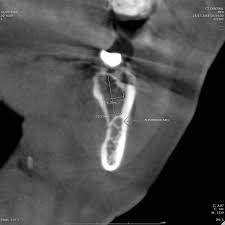 cone beam ct dental radiologie dr