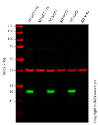 recombinant anti p21 antibody epr362