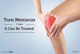 torn meniscus knee treatment exercise