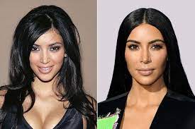 kim kardashian s cosmetic surgeries and