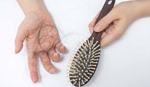 Image result for hair loss