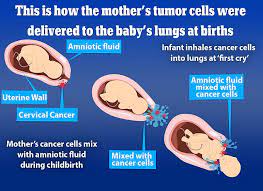 A team at the institute of cancer. Two Babies Caught Cancer From Their Mothers During Childbirth Australiannewsreview