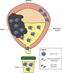 Urine Derived Lymphocytes As A Non Invasive Measure Of The
