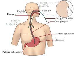ati chapter 54 nasogastric intubation