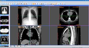 Dicom viewer provides high quality image processing optimally designed for computed radiography. Sante Dicom Viewer Pro Santesoft Ltd