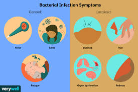 bacterial infection symptoms causes