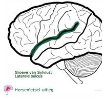 insula impact per brain area