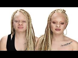 makeup tutorial for women with albinism