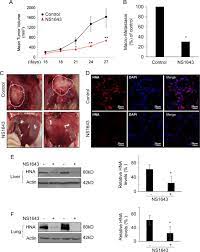 t cancer metastasis