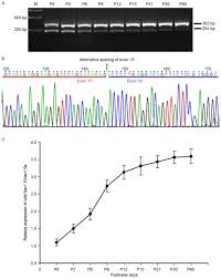 Multiple Nav1 5 Isoforms Are Functionally Expressed In The