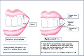anterior teeth display and lip position
