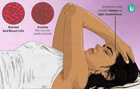 anemia symptoms causes treatment