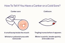 canker sore vs cold sore symptoms