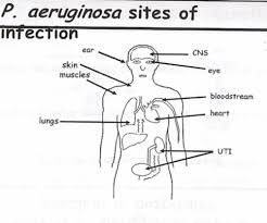 pseudomonas aeruginosa flashcards quizlet