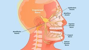 what is trigeminal neuralgia symptoms
