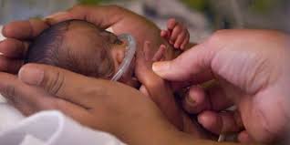 Perawatan bayi yang lahir prematur di rumah - LuviZhea