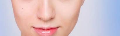 natural makeup for acne e skin