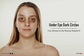 under eye dark circles can stress be