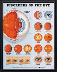 Disorders Of The Eye Chart 20x26 Eye Anatomy Eye Cataract