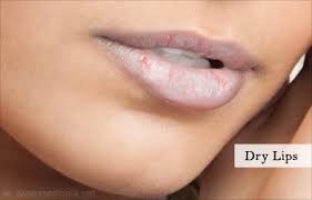swollen lips lip edema symptom evaluation