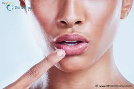 how to treat dark lips dermatology