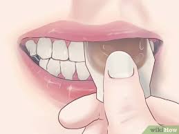 how to treat gum disease with homemade